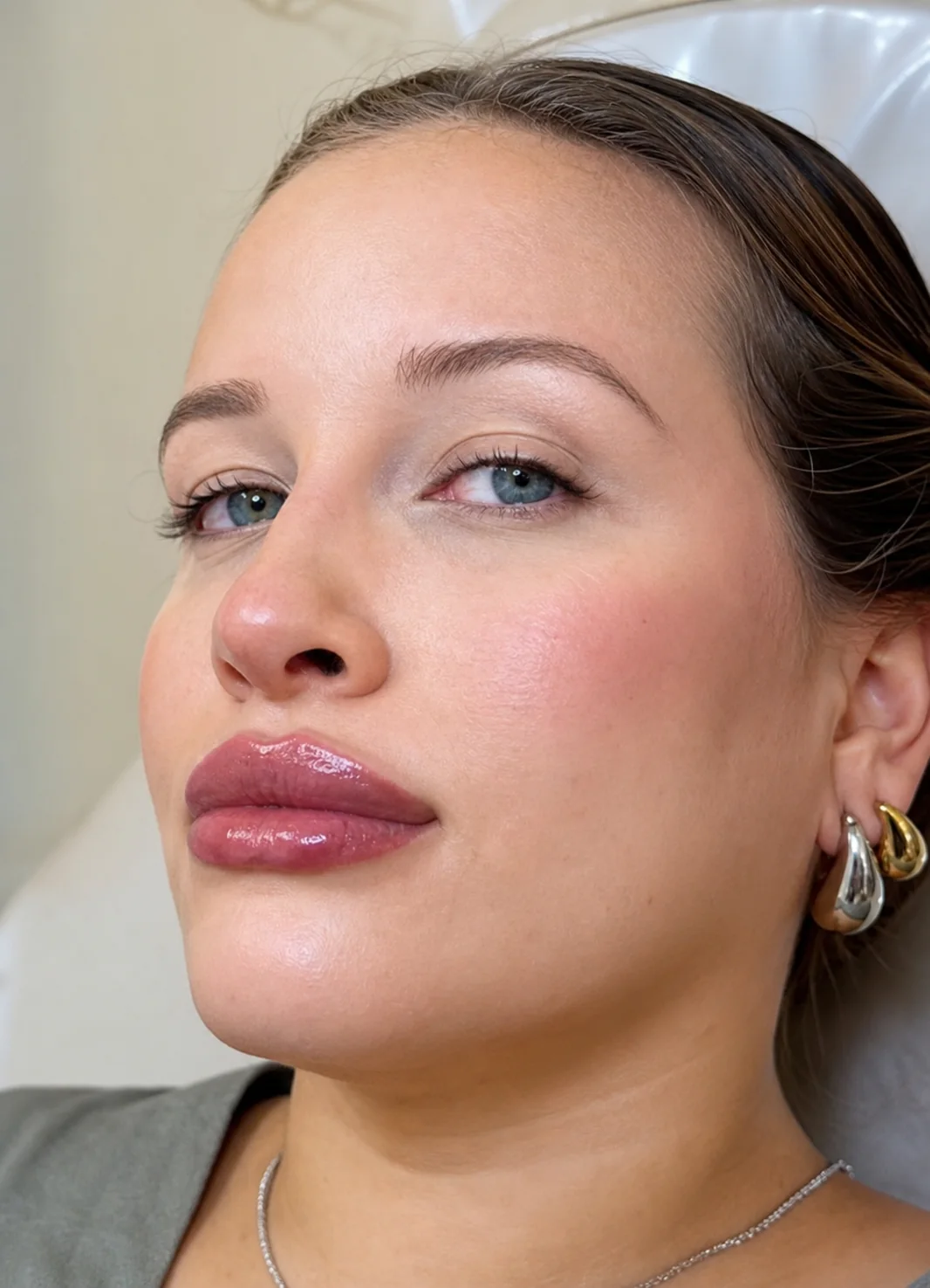 Resultado de cuidado facial na clínica estética
